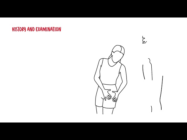 Thumbnail for YouTube medical video: Trochanteric bursitis