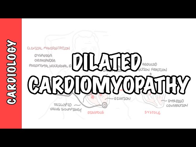 Thumbnail for YouTube medical video: Dilated Cardiomyopathy - causes, symptoms, pathophysiology and treatment