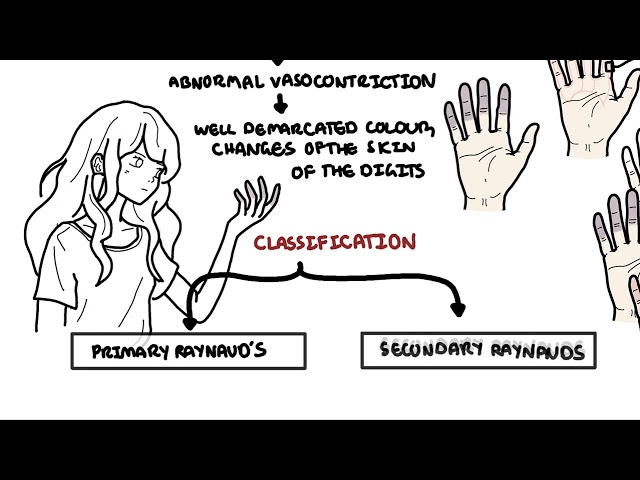 Thumbnail for YouTube medical video: Raynaud's Phenomenon - mechanism