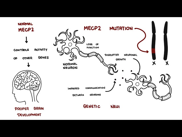 Thumbnail for YouTube medical video: Rett Syndrome