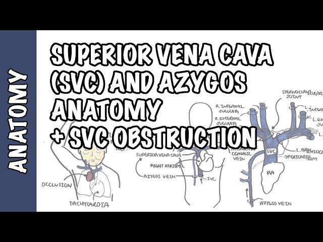 Thumbnail for YouTube medical video: Superior vena cava and the azygos system clinical anatomy - SVC obstruction…