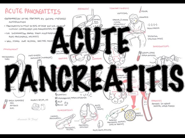 Thumbnail for YouTube medical video: Acute Pancreatitis - Overview (signs and symptoms, pathophysiology, investigations…
