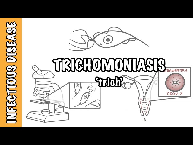 Thumbnail for YouTube medical video: Trichomoniasis