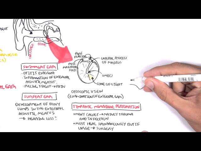 Thumbnail for YouTube medical video: Anatomy - Middle Ear — Anatomy