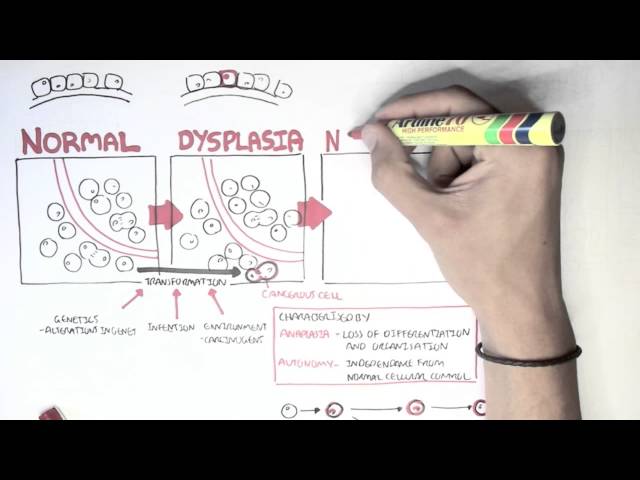 Thumbnail for YouTube medical video: Cancer - Introduction II — Others