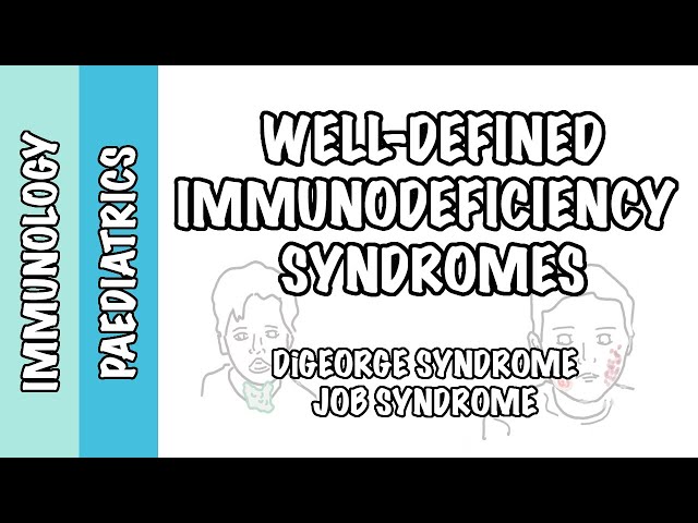 Thumbnail for YouTube medical video: Well defined genetic immunodeficiency - DiGeorge Syndrome and Job Syndrome