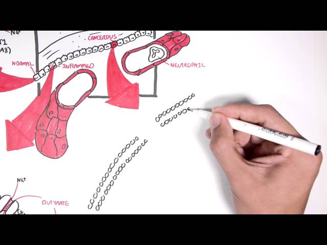 Thumbnail for YouTube medical video: Molecular effects of Butyrate