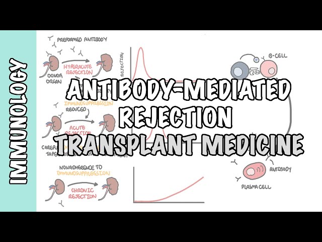 Thumbnail for YouTube medical video: Transplant Medicine - Antibody mediated rejection