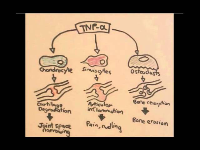 Thumbnail for YouTube medical video: Etanercept