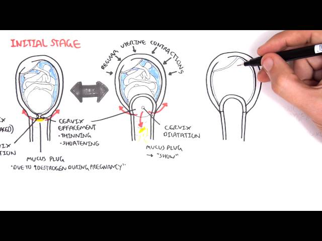 Thumbnail for YouTube medical video: Obstetrics - Stage I of Labour — Reproductive System>Medical Physiology