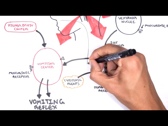 Thumbnail for YouTube medical video: Physiology of Vomiting - Vomiting reflex (NEW) — Digestive System