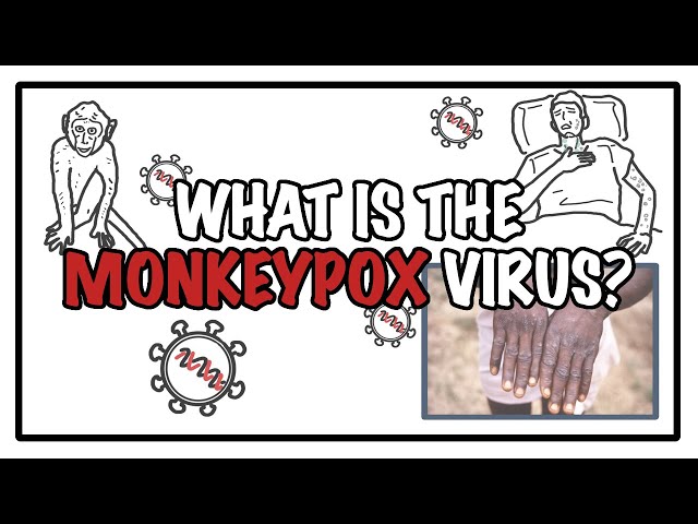 Thumbnail for YouTube medical video: What is the Monkeypox virus?