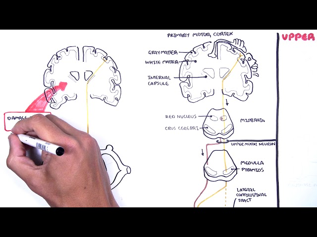 Thumbnail for YouTube medical video: Introduction to Upper and Lower Motor Neuron Lesions