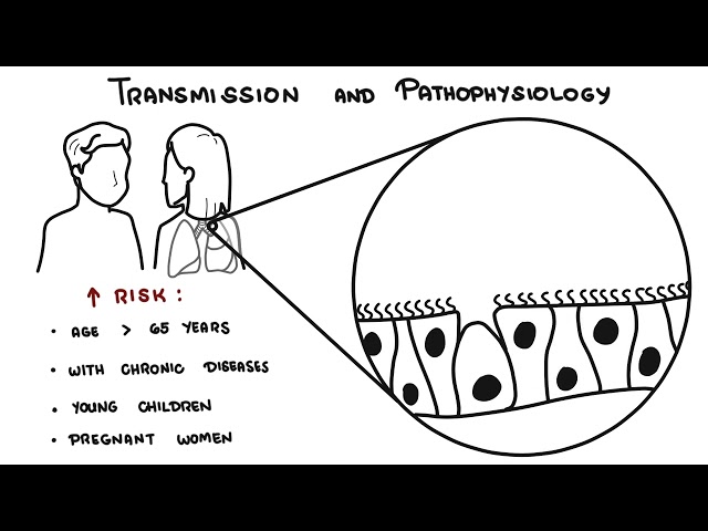 Thumbnail for YouTube medical video: Understanding Influenza - The Flu