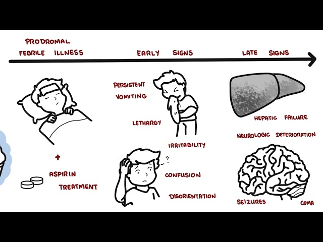 Thumbnail for YouTube medical video: Reye's Syndrome