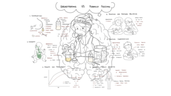 Breastfeeding vs Formula feeding