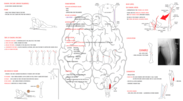 Femoral shaft fracture