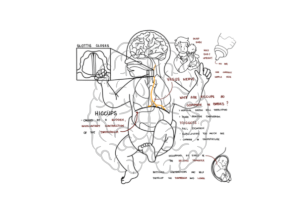 Hiccups - paediatrics