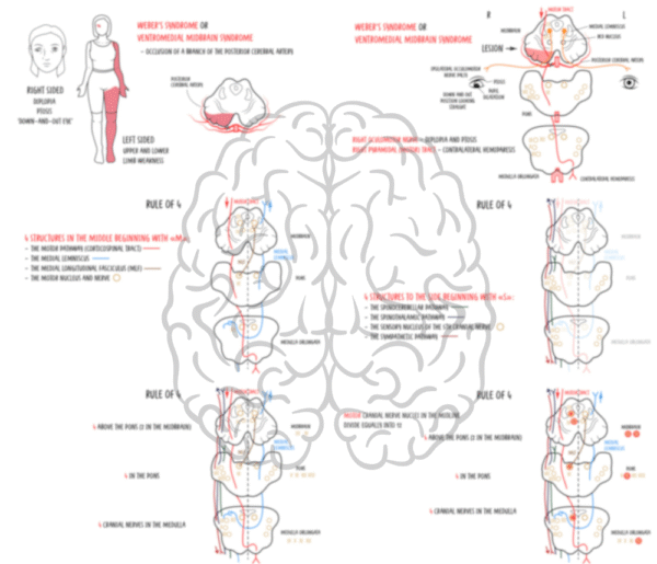 Midbrain Syndromes