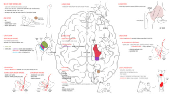 Neck of femur fracture