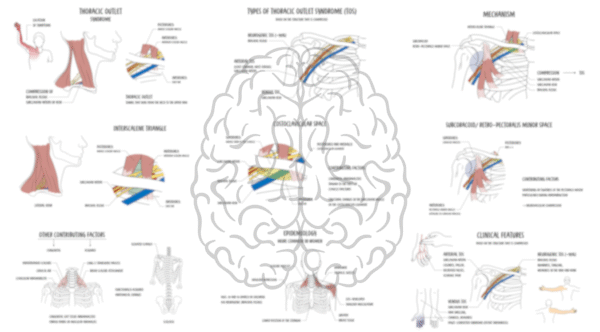 Thoracic Outlet Obstruction