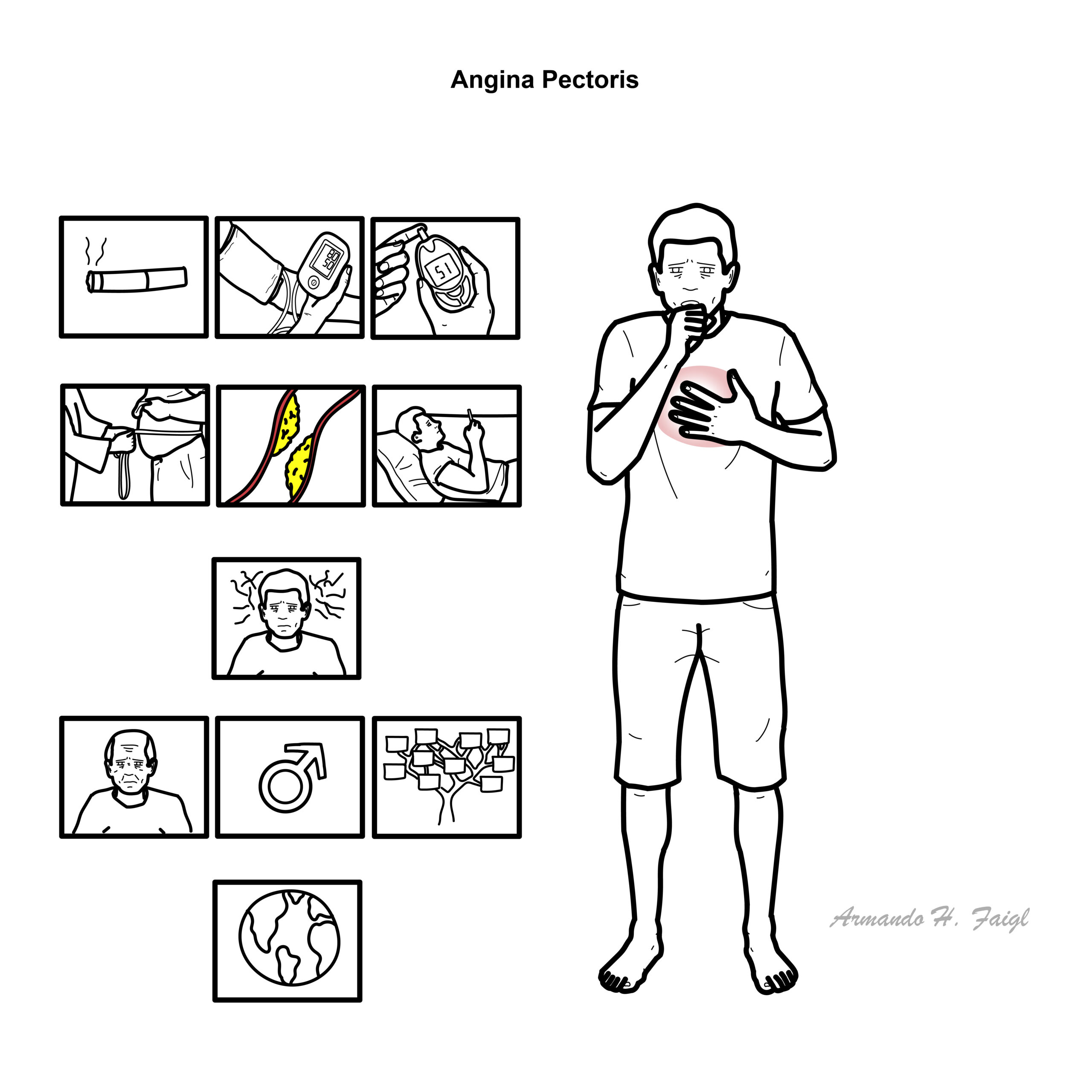 Infographic on angina pectoris showing chest pain symptoms (dyspnoea, fatigue, nausea/vomiting) and risk factors list.