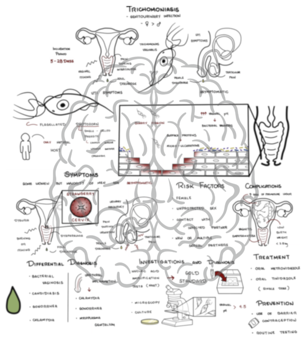 Trichomoniasis