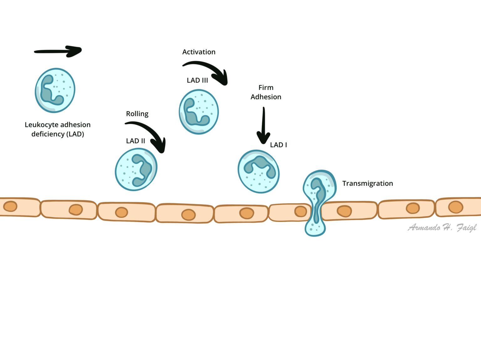 Leukocyte Adhesion Deficiency Armando Hasudungan
