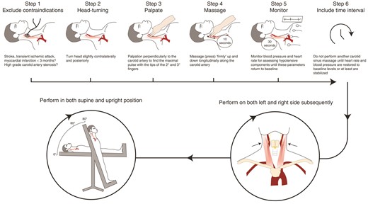 Six-step method for monitored carotid sinus massage in supine and upright positions
